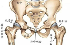 预后效果如何？股骨头坏死保守治疗疗效显著